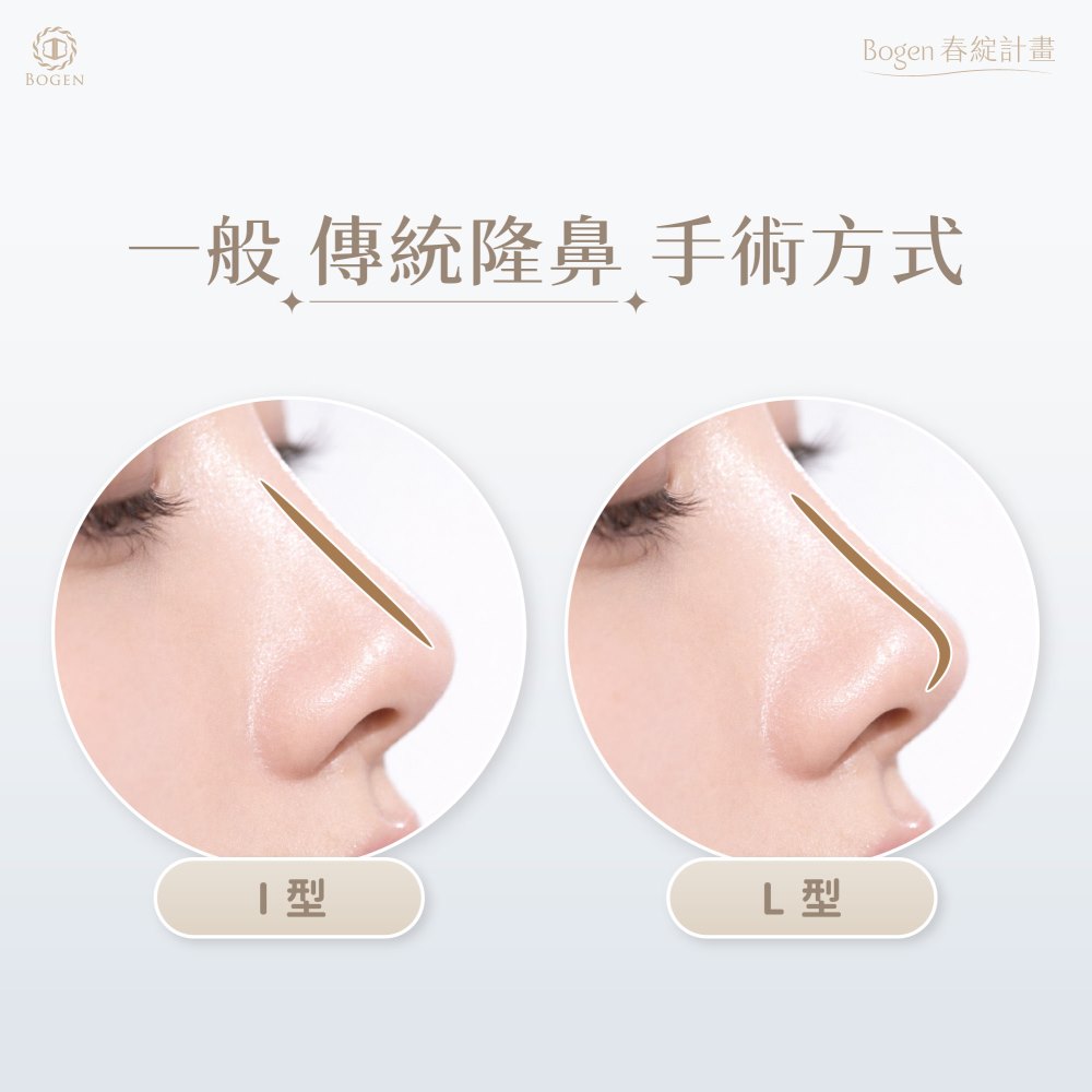 傳統隆鼻手術,博恩妍